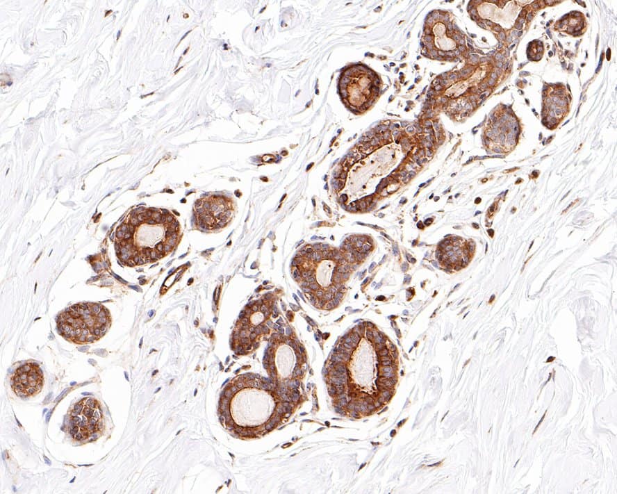 Immunohistochemistry: ROBO1 Antibody (10E2-R) [NBP3-32913] - Immunohistochemical analysis of paraffin-embedded human breast tissue with Rabbit anti-ROBO1 antibody (NBP3-32913) at 1/600 dilution. The section was pre-treated using heat mediated antigen retrieval with Tris-EDTA buffer (pH 9.0) for 20 minutes. The tissues were blocked in 1% BSA for 20 minutes at room temperature, washed with ddH2O and PBS, and then probed with the primary antibody (NBP3-32913) at 1/600 dilution for 1 hour at room temperature. The detection was performed using an HRP conjugated compact polymer system. DAB was used as the chromogen. Tissues were counterstained with hematoxylin and mounted with DPX.