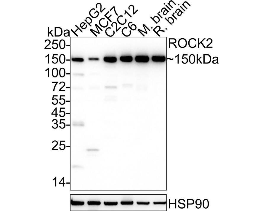 Western blot analysis on different lysates with NBP3-32914 at 1/1,000 dilution. Lane 1: HepG2 cell lysate Lane 2: MCF7 cell lysate Lane 3: C2C12 cell lysate Lane 4: C6 cell lysate Lane 5: Mouse brain tissue lysate Lane 6: Rat brain tissue lysate Lysates/proteins at 20 µg/Lane. Predicted band size: 161 kDa Observed band size: 150 kDa Exposure time: 59 seconds;  4-20% SDS-PAGE gel. Proteins were transferred to a PVDF membrane and blocked with 5% NFDM/TBST for 1 hour at room temperature. NBP3-32914 at 1/1,000 dilution was used in 5% NFDM/TBST at 4℃ overnight. Goat Anti-Rabbit IgG [HRP] Secondary Antibody at 1/50,000 dilution was used for 1 hour at room temperature.
