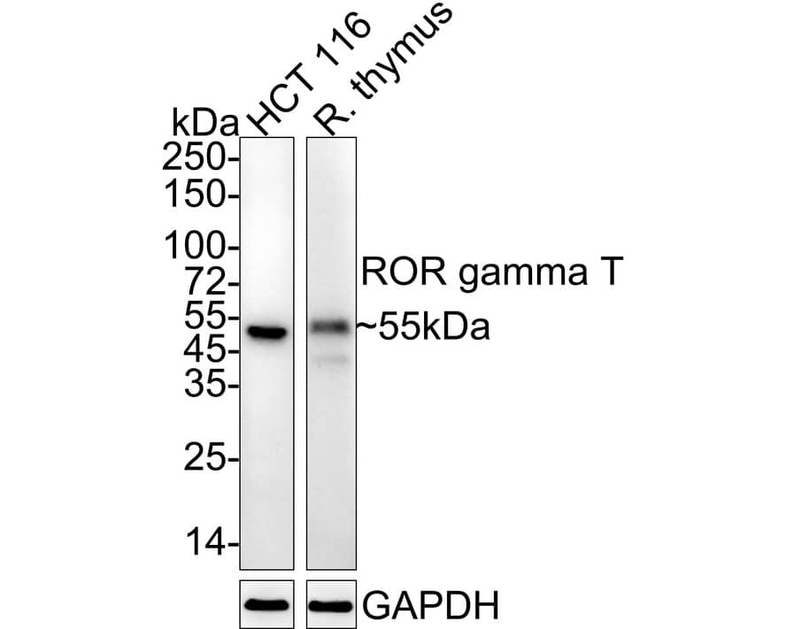 Western blot analysis on different lysates with NBP3-32915 at 1/2,000 dilution. Lane 1: HCT 116 cell lysate Lane 2: Rat thymus tissue lysate Lysates/proteins at 20 µg/Lane. Predicted band size: 58 kDa Observed band size: 55 kDa Exposure time: 3 minutes;  4-20% SDS-PAGE gel. Proteins were transferred to a PVDF membrane and blocked with 5% NFDM/TBST for 1 hour at room temperature. NBP3-32915 at 1/2,000 dilution was used in 5% NFDM/TBST at 4℃ overnight. Goat Anti-Rabbit IgG [HRP] Secondary Antibody at 1/50,000 dilution was used for 1 hour at room temperature.