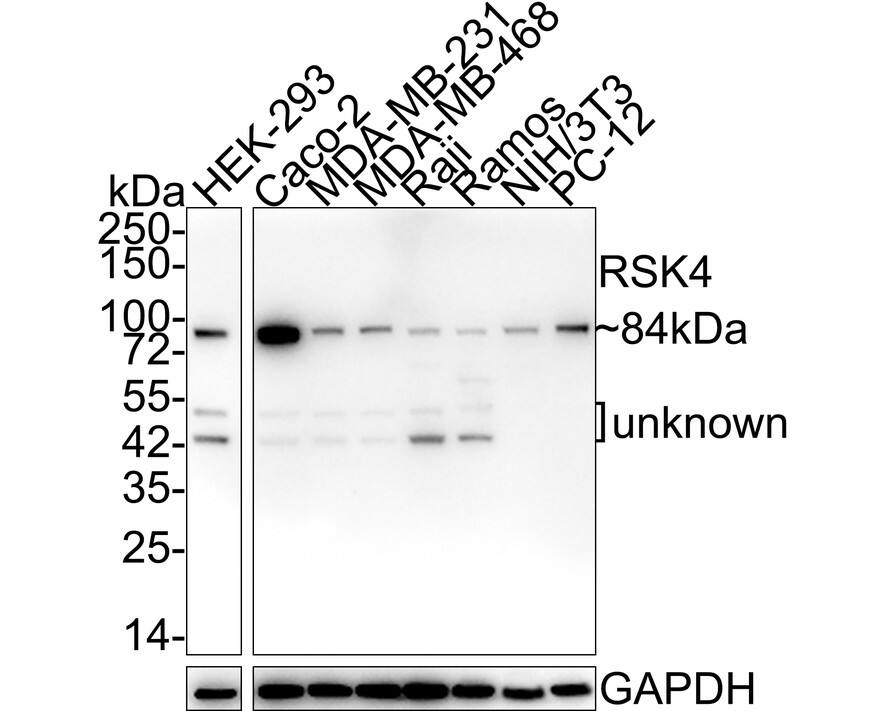 Western blot analysis on different lysates with NBP3-32920 at 1/1,000 dilution. Lane 1: HEK-293 cell lysate Lane 2: Caco-2 cell lysate Lane 3: MDA-MB-231 cell lysate Lane 4: MDA-MB-468 cell lysate Lane 5: Raji cell lysate Lane 6: Ramos cell lysate Lane 7: NIH/3T3 cell lysate Lane 8: PC-12 cell lysate Lysates/proteins at 20 µg/Lane. Predicted band size: 84 kDa Observed band size: 84 kDa Exposure time: 1 minute 14 seconds; 4-20% SDS-PAGE gel. Proteins were transferred to a PVDF membrane and blocked with 5% NFDM/TBST for 1 hour at room temperature. NBP3-32920 at 1/1,000 dilution was used in 5% NFDM/TBST at room temperature for 2 hours. Goat Anti-Rabbit IgG [HRP] Secondary Antibody at 1/50,000 dilution was used for 1 hour at room temperature.