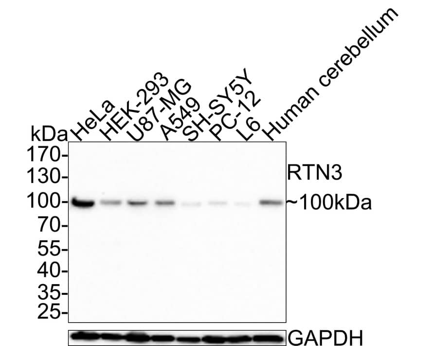 Western Blot: RTN3 Antibody (PSH0-40) [NBP3-32921] - Western blot analysis of RTN3 on different lysates with Rabbit anti-RTN3 antibody (NBP3-32921) at 1/1,000 dilution. Lane 1: HeLa cell lysate (32 ug/Lane) Lane 2: HEK-293 cell lysate (33 ug/Lane) Lane 3: U87-MG cell lysate (30 ug/Lane) Lane 4: A549 cell lysate (26 ug/Lane) Lane 5: SH-SY5Y cell lysate (18 ug/Lane) Lane 6: PC-12 cell lysate (23 ug/Lane) Lane 7: L6 cell lysate (14 ug/Lane) Lane 8: Human cerebellum tissue lysate (40 ug/Lane) Lysates/proteins at 10 ug/Lane. Predicted band size: 112.6 kDa Observed band size: 100 kDa Exposure time: 3 minutes; 4-20% SDS-PAGE gel. Proteins were transferred to a PVDF membrane and blocked with 5% NFDM/TBST for 1 hour at room temperature. The primary antibody (NBP3-32921) at 1/1,000 dilution was used in 5% NFDM/TBST at room temperature for 2 hours. Goat Anti-Rabbit IgG - HRP Secondary Antibody at 1:200,000 dilution was used for 1 hour at room temperature.