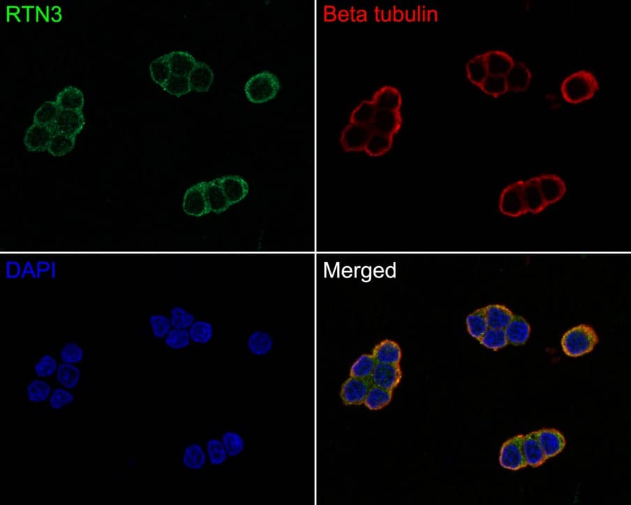 Immunocytochemistry/ Immunofluorescence: RTN3 Antibody (PSH0-40) [NBP3-32921] - Immunocytochemistry analysis of PC-12 cells labeling RTN3 with Rabbit anti-RTN3 antibody (NBP3-32921) at 1/50 dilution. Cells were fixed in 4% paraformaldehyde for 10 minutes at 37 ℃, permeabilized with 0.05% Triton X-100 in PBS for 20 minutes, and then blocked with 2% negative goat serum for 30 minutes at room temperature. Cells were then incubated with Rabbit anti-RTN3 antibody (NBP3-32921) at 1/50 dilution in 2% negative goat serum overnight at 4 ℃. Goat Anti-Rabbit IgG H&L (iFluor™ 488) was used as the secondary antibody at 1/1,000 dilution. Nuclear DNA was labelled in blue with DAPI. Beta tubulin (red) was stained at 1/100 dilution overnight at +4℃. Goat Anti-Mouse IgG H&L (iFluor™ 594) was used as the secondary antibody at 1/1,000 dilution.