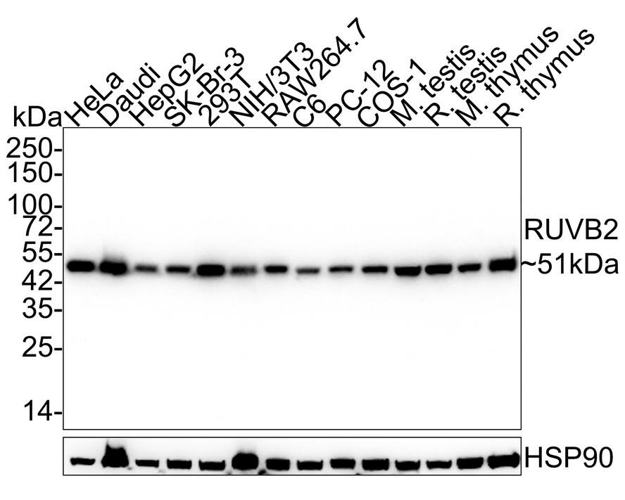 Western blot analysis on different lysates with NBP3-32922 at 1/2,000 dilution. Lane 1: HeLa cell lysate (20 µg/Lane) Lane 2: Daudi cell lysate (20 µg/Lane) Lane 3: HepG2 cell lysate (20 µg/Lane) Lane 4: SK-Br-3 cell lysate (20 µg/Lane) Lane 5: 293T cell lysate (20 µg/Lane) Lane 6: NIH/3T3 cell lysate (20 µg/Lane) Lane 7: RAW264.7 cell lysate (20 µg/Lane) Lane 8: C6 cell lysate (20 µg/Lane) Lane 9: PC-12 cell lysate (20 µg/Lane) Lane 10: COS-1 cell lysate (20 µg/Lane) Lane 11: Mouse testis tissue lysate (40 µg/Lane) Lane 12: Rat testis tissue lysate (40 µg/Lane) Lane 13: Mouse thymus tissue lysate (40 µg/Lane) Lane 14: Rat thymus tissue lysate (40 µg/Lane) Predicted band size: 51 kDa Observed band size: 51 kDa Exposure time: 43 seconds; 4-20% SDS-PAGE gel. Proteins were transferred to a PVDF membrane and blocked with 5% NFDM/TBST for 1 hour at room temperature. NBP3-32922 at 1/2,000 dilution was used in 5% NFDM/TBST at 4℃ overnight. Goat anti-Mouse IgG [HRP] at 1/50,000 dilution was used for 1 hour at room temperature.