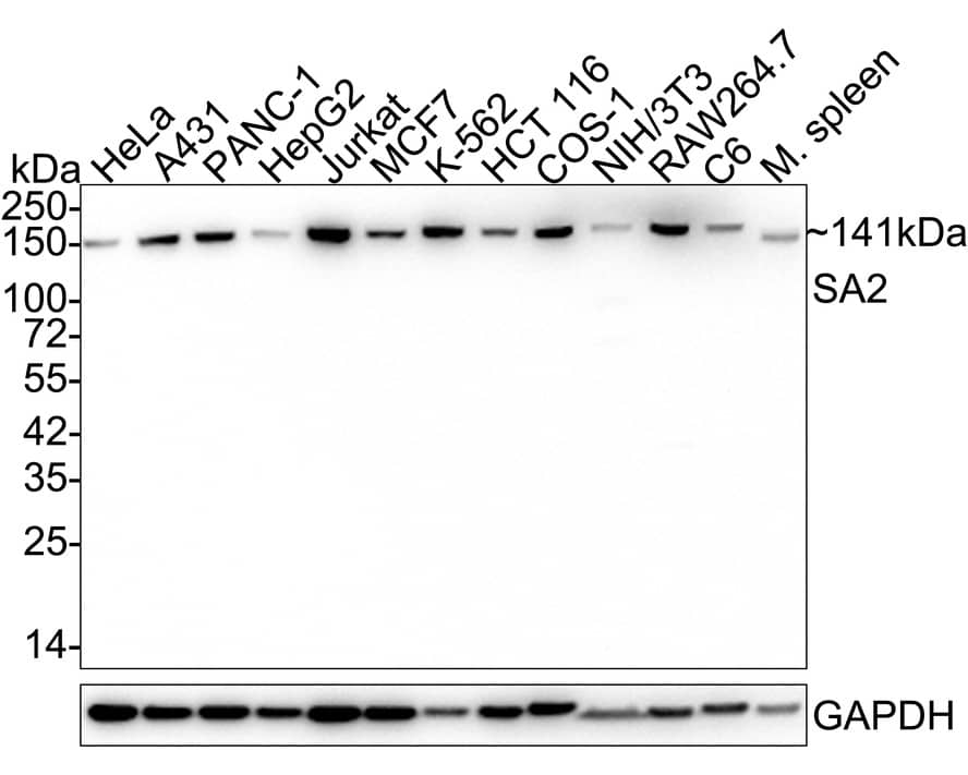 Western Blot STAG2 Antibody (JE57-34)