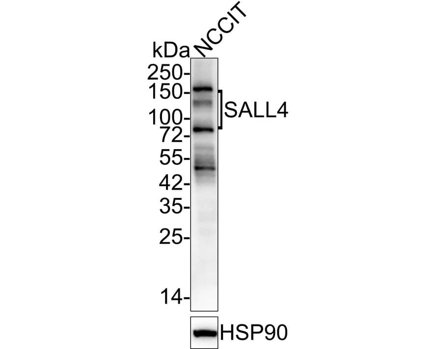 Western Blot: SALL4 Antibody (A9G9-R) [NBP3-32926] - Western blot analysis of SALL4 on NCCIT cell lysates with Mouse anti-SALL4 antibody (NBP3-32926) at 1/2,000 dilution. Lysates/proteins at 20 ug/Lane. Predicted band size: 112 kDa Observed band size: 140/110/75 kDa Exposure time: 1 minute 26 seconds; 4-20% SDS-PAGE gel. Proteins were transferred to a PVDF membrane and blocked with 5% NFDM/TBST for 1 hour at room temperature. The primary antibody (NBP3-32926) at 1/2,000 dilution was used in 5% NFDM/TBST at 4C overnight. Goat Anti-Mouse IgG - HRP Secondary Antibody at 1/50,000 dilution was used for 1 hour at room temperature.