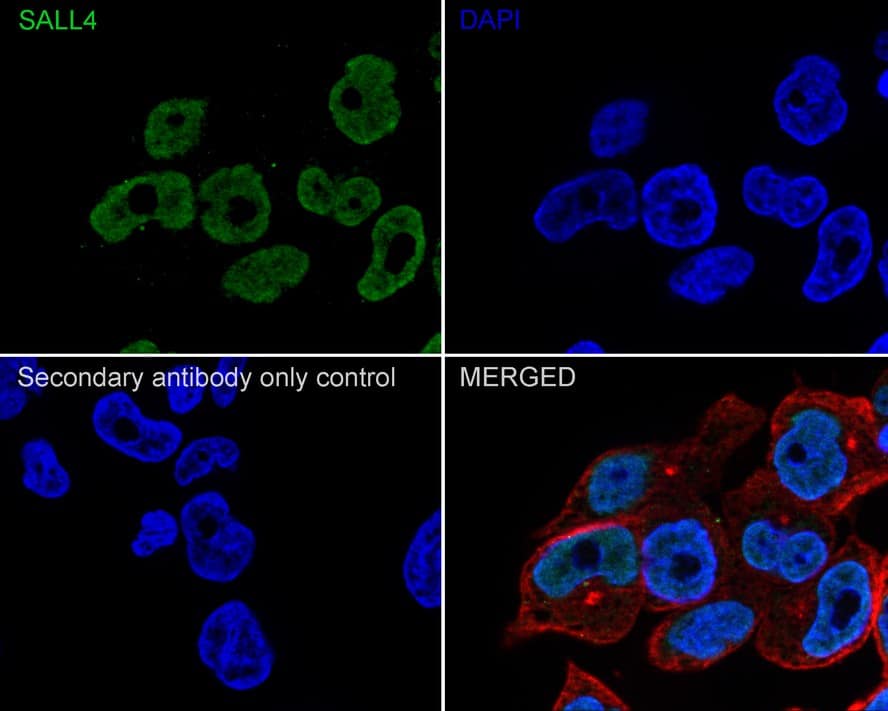 Immunocytochemistry/ Immunofluorescence: SALL4 Antibody (A9G9-R) [NBP3-32926] - Immunocytochemistry analysis of NCCIT cells labeling SALL4 with Mouse anti-SALL4 antibody (NBP3-32926) at 1/100 dilution. Cells were fixed in 4% paraformaldehyde for 20 minutes at room temperature, permeabilized with 0.1% Triton X-100 in PBS for 5 minutes at room temperature, then blocked with 1% BSA in 10% negative goat serum for 1 hour at room temperature. Cells were then incubated with Mouse anti-SALL4 antibody (NBP3-32926) at 1/100 dilution in 1% BSA in PBST overnight at 4 ℃. Goat Anti-Mouse IgG H&L (iFluor™ 488) was used as the secondary antibody at 1/1,000 dilution. PBS instead of the primary antibody was used as the secondary antibody only control. Nuclear DNA was labelled in blue with DAPI. beta Tubulin (red) was stained at 1/100 dilution overnight at +4℃. Goat Anti-Rabbit IgG H&L (iFluor™ 594) were used as the secondary antibody at 1/1,000 dilution.