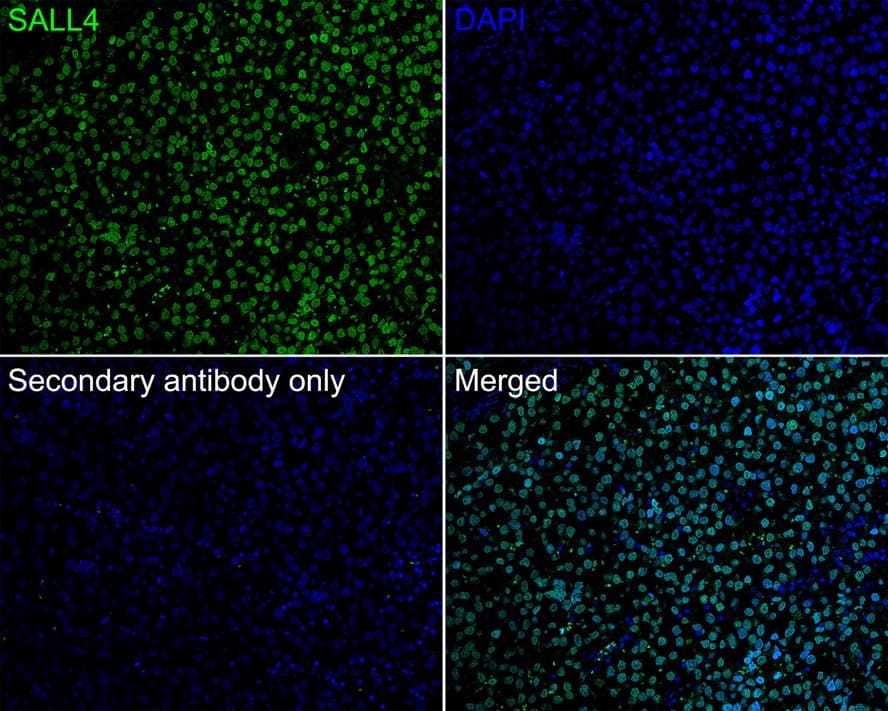 Immunohistochemistry: SALL4 Antibody (A9G9-R) [NBP3-32926] - Immunofluorescence analysis of paraffin-embedded human seminoma tissue labeling SALL4 with Mouse anti-SALL4 antibody (NBP3-32926) at 1/200 dilution. The section was pre-treated using heat mediated antigen retrieval with sodium citrate buffer (pH 6.0) for 2 minutes. The tissues were blocked in 10% negative goat serum for 1 hour at room temperature, washed with PBS, and then probed with the primary antibody (NBP3-32926, green) at 1/200 dilution overnight at 4 ℃, washed with PBS. Goat Anti-Mouse IgG H&L (iFluor™ 488) was used as the secondary antibody at 1/1,000 dilution. Nuclei were counterstained with DAPI (blue).