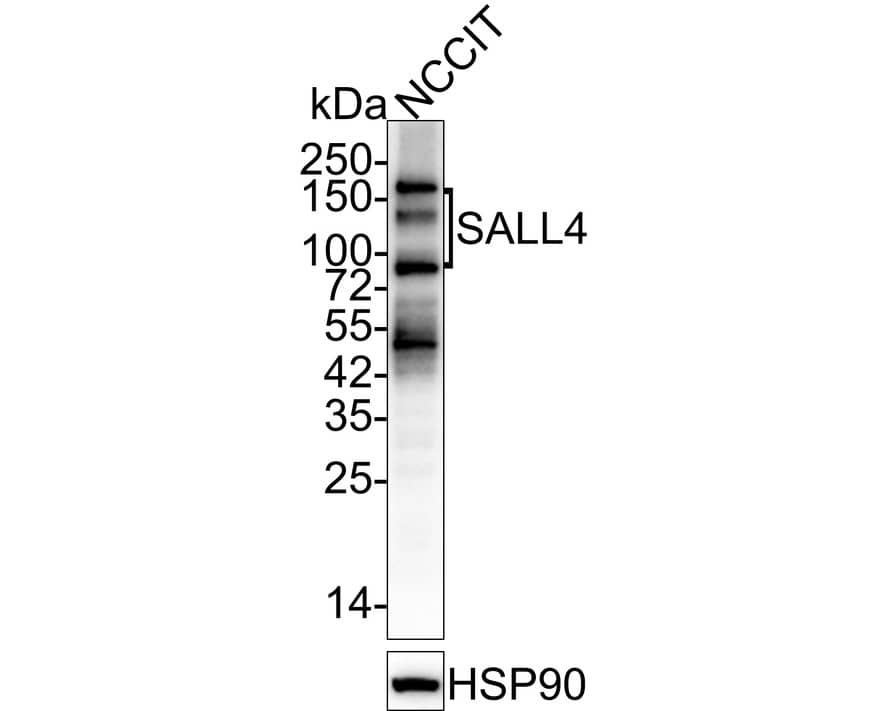 Western Blot: SALL4 Antibody (A7A7-R) [NBP3-32927] - Western blot analysis of SALL4 on NCCIT cell lysates with Mouse anti-SALL4 antibody (NBP3-32927) at 1/2,000 dilution. Predicted band size: 112 kDa, 20 ug/Lane Observed band size: 140/110/75 kDa, 20 ug/Lane Exposure time: 1 minute 26 seconds; 4-20% SDS-PAGE gel. Proteins were transferred to a PVDF membrane and blocked with 5% NFDM/TBST for 1 hour at room temperature. The primary antibody (NBP3-32927) at 1/2,000 dilution was used in 5% NFDM/TBST at 4C overnight. Goat Anti-Mouse IgG - HRP Secondary Antibody at 1/50,000 dilution was used for 1 hour at room temperature.