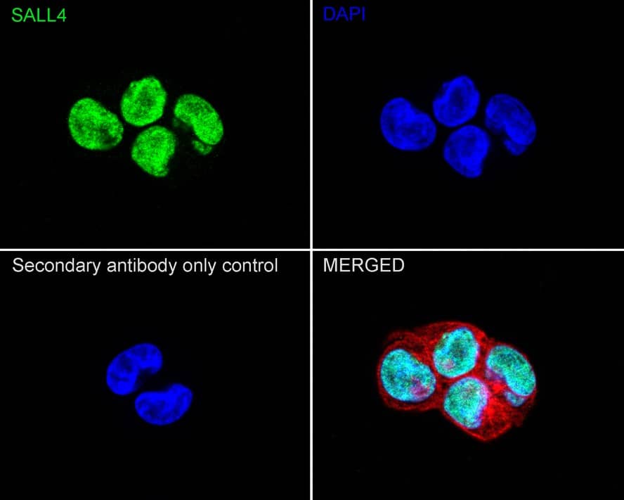 Immunocytochemistry/ Immunofluorescence: SALL4 Antibody (A7A7-R) [NBP3-32927] - Immunocytochemistry analysis of NCCIT cells labeling SALL4 with Mouse anti-SALL4 antibody (NBP3-32927) at 1/100 dilution. Cells were fixed in 4% paraformaldehyde for 20 minutes at room temperature, permeabilized with 0.1% Triton X-100 in PBS for 5 minutes at room temperature, then blocked with 1% BSA in 10% negative goat serum for 1 hour at room temperature. Cells were then incubated with Mouse anti-SALL4 antibody (NBP3-32927) at 1/100 dilution in 1% BSA in PBST overnight at 4 ℃. Goat Anti-Mouse IgG H&L (iFluor™ 488) was used as the secondary antibody at 1/1,000 dilution. PBS instead of the primary antibody was used as the secondary antibody only control. Nuclear DNA was labelled in blue with DAPI. Beta Tubulin (red) was stained at 1/100 dilution overnight at +4℃. Goat Anti-Rabbit IgG H&L (iFluor™ 594) were used as the secondary antibody at 1/1,000 dilution.