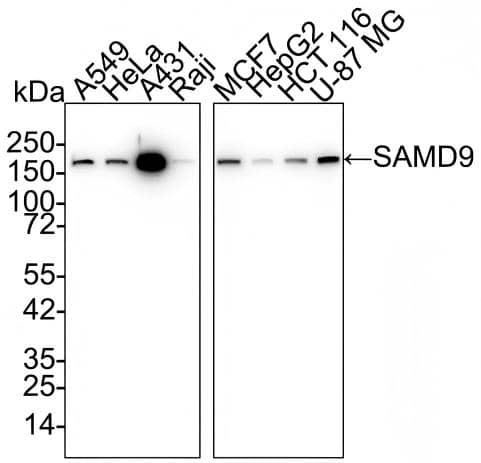 Western blot analysis on different lysates with NBP3-32928 at 1/1,000 dilution and competitor's antibody at 1/1,000 dilution. Lane 1: A549 cell lysate Lane 2: HeLa cell lysate Lane 3: A431 cell lysate Lane 4: Raji cell lysate Lane 5: MCF7 cell lysate Lane 6: HepG2 cell lysate Lane 7: HCT 116 cell lysate Lane 8: U-87 MG cell lysate Lysates/proteins at 20 µg/Lane. Predicted band size: 184 kDa Observed band size: 184 kDa Exposure time: 2 minutes;  4-20% SDS-PAGE gel. Proteins were transferred to a PVDF membrane and blocked with 5% NFDM/TBST for 1 hour at room temperature. NBP3-32928 at 1/1,000 dilution and competitor's antibody at 1/1,000 dilution were used in 5% NFDM/TBST at 4℃ overnight. Goat Anti-Rabbit IgG [HRP] Secondary Antibody at 1/50,000 dilution was used for 1 hour at room temperature.