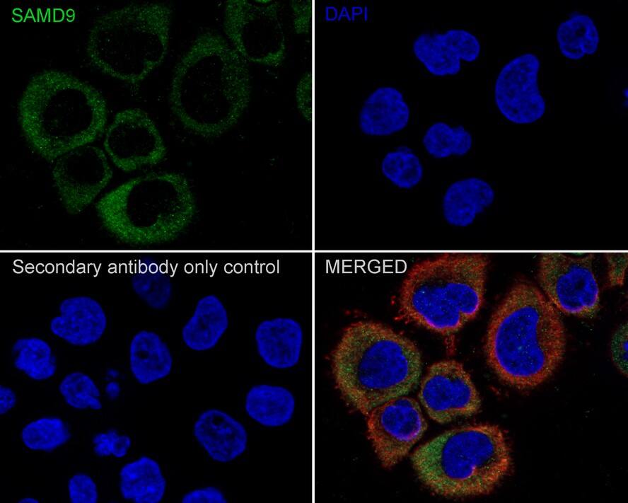 Immunocytochemistry/ Immunofluorescence: SAMD9 Antibody (PSH02-75) [NBP3-32928] - Immunocytochemistry analysis of A431 cells labeling SAMD9 with Rabbit anti-SAMD9 antibody (NBP3-32928) at 1/100 dilution. Cells were fixed in 4% paraformaldehyde for 20 minutes at room temperature, permeabilized with 0.1% Triton X-100 in PBS for 5 minutes at room temperature, then blocked with 1% BSA in 10% negative goat serum for 1 hour at room temperature. Cells were then incubated with Rabbit anti-SAMD9 antibody (NBP3-32928) at 1/100 dilution in 1% BSA in PBST overnight at 4 ℃. Goat Anti-Rabbit IgG H&L (iFluor™ 488) was used as the secondary antibody at 1/1,000 dilution. PBS instead of the primary antibody was used as the secondary antibody only control. Nuclear DNA was labelled in blue with DAPI. Beta tubulin (red) was stained at 1/100 dilution overnight at +4℃. Goat Anti-Mouse IgG H&L (iFluor™ 594) was used as the secondary antibody at 1/1,000 dilution.