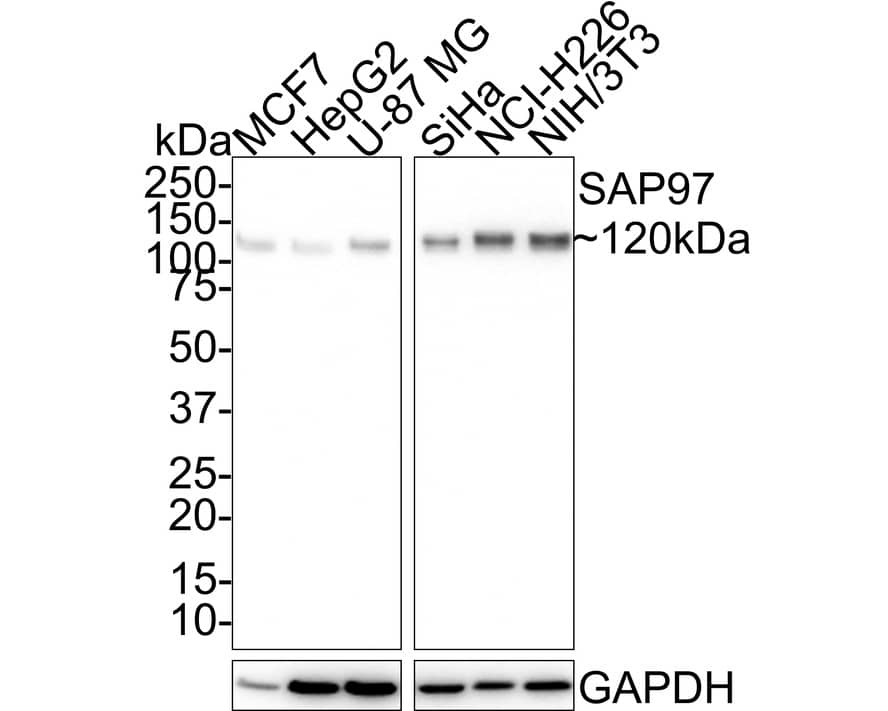 Western Blot: DLG1 Antibody (JE39-74) [NBP3-32929] - Western blot analysis of DLG1 on different lysates with Rabbit anti-DLG1 antibody (NBP3-32929) at 1/1,000 dilution. Lane 1: MCF7 cell lysate Lane 2: HepG2 cell lysate Lane 3: U-87 MG cell lysate Lane 4: SiHa cell lysate Lane 5: NCI-H226 cell lysate Lane 6: NIH/3T3 cell lysate Lysates/proteins at 20 ug/Lane. Predicted band size: 100 kDa Observed band size: 120 kDa Exposure time: 1 minute 55 seconds; 4-20% SDS-PAGE gel. Proteins were transferred to a PVDF membrane and blocked with 5% NFDM/TBST for 1 hour at room temperature. The primary antibody (NBP3-32929) at 1/1,000 dilution was used in 5% NFDM/TBST at 4C overnight. Goat Anti-Rabbit IgG - HRP Secondary Antibody at 1:100,000 dilution was used for 1 hour at room temperature.