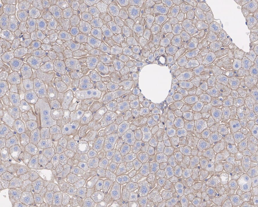 Immunohistochemistry: DLG1 Antibody (JE39-74) [NBP3-32929] - Immunohistochemical analysis of paraffin-embedded mouse liver tissue with Rabbit anti-DLG1 antibody (NBP3-32929) at 1/200 dilution. The section was pre-treated using heat mediated antigen retrieval with Tris-EDTA buffer (pH 9.0) for 20 minutes. The tissues were blocked in 1% BSA for 20 minutes at room temperature, washed with ddH2O and PBS, and then probed with the primary antibody (NBP3-32929) at 1/200 dilution for 1 hour at room temperature. The detection was performed using an HRP conjugated compact polymer system. DAB was used as the chromogen. Tissues were counterstained with hematoxylin and mounted with DPX.