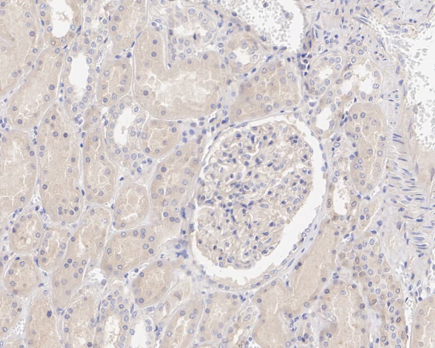 Immunohistochemistry: SAV1 Antibody (PSH04-45) [NBP3-32931] - Immunohistochemical analysis of paraffin-embedded human kidney tissue with Rabbit anti-SAV1 antibody (NBP3-32931) at 1/200 dilution. The section was pre-treated using heat mediated antigen retrieval with Tris-EDTA buffer (pH 9.0) for 20 minutes. The tissues were blocked in 1% BSA for 20 minutes at room temperature, washed with ddH2O and PBS, and then probed with the primary antibody (NBP3-32931) at 1/200 dilution for 1 hour at room temperature. The detection was performed using an HRP conjugated compact polymer system. DAB was used as the chromogen. Tissues were counterstained with hematoxylin and mounted with DPX.