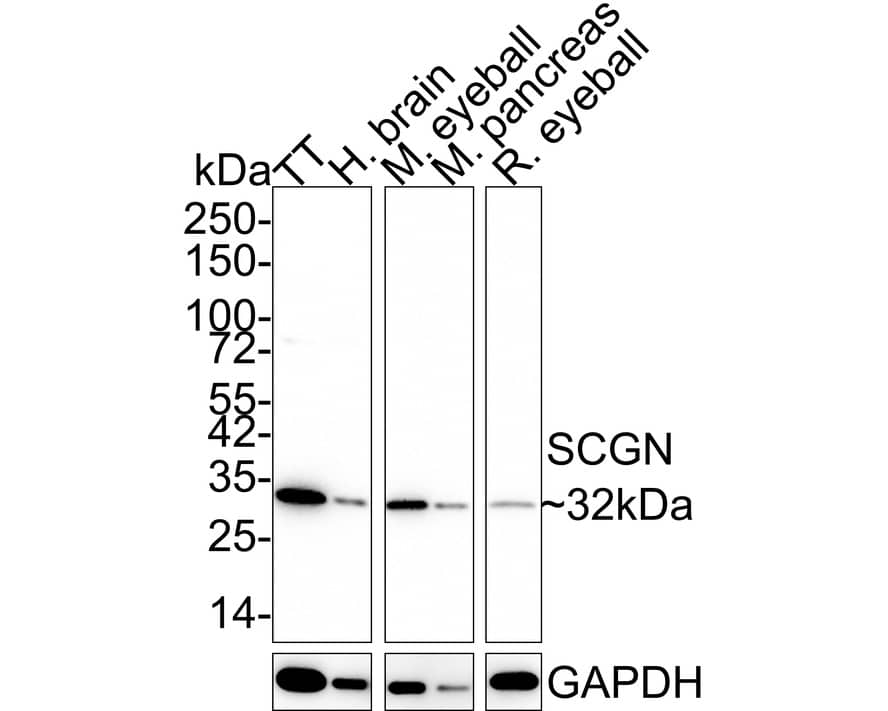 Western Blot: Secretagogin Antibody (JE60-48) [NBP3-32933] - Western blot analysis of Secretagogin on different lysates with Rabbit anti-Secretagogin antibody (NBP3-32933) at 1/2,000 dilution. Lane 1: TT cell lysate Lane 2: Human brain tissue lysate Lane 3: Mouse eyeball tissue lysate Lane 4: Mouse pancreas tissue lysate Lane 5: Rat eyeball tissue lysate Lysates/proteins at 20 ug/Lane. Predicted band size: 32 kDa Observed band size: 32 kDa Exposure time: 5 minutes; 4-20% SDS-PAGE gel. Proteins were transferred to a PVDF membrane and blocked with 5% NFDM/TBST for 1 hour at room temperature. The primary antibody (NBP3-32933) at 1/2,000 dilution was used in 5% NFDM/TBST at 4C overnight. Goat Anti-Rabbit IgG - HRP Secondary Antibody at 1/50,000 dilution was used for 1 hour at room temperature.