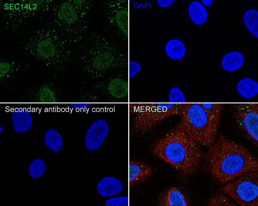 Immunocytochemistry/ Immunofluorescence: SEC14L2 Antibody (JE61-74) [NBP3-32935] - Immunocytochemistry analysis of A549 cells labeling SEC14L2 with Rabbit anti-SEC14L2 antibody (NBP3-32935) at 1/100 dilution. Cells were fixed in 4% paraformaldehyde for 10 minutes at 37 ℃, permeabilized with 0.05% Triton X-100 in PBS for 20 minutes, and then blocked with 2% negative goat serum for 30 minutes at room temperature. Cells were then incubated with Rabbit anti-SEC14L2 antibody (NBP3-32935) at 1/100 dilution in 2% negative goat serum overnight at 4 ℃. Goat Anti-Rabbit IgG H&L (iFluor™ 488) was used as the secondary antibody at 1/1,000 dilution. Nuclear DNA was labelled in blue with DAPI. Beta tubulin (red) was stained at 1/200 dilution overnight at +4℃. Goat Anti-Mouse IgG H&L (iFluor™ 594) was used as the secondary antibody at 1/1,000 dilution.