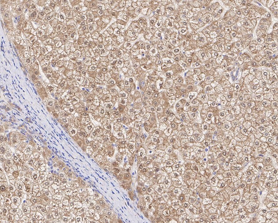 Immunohistochemistry: SEC14L2 Antibody (JE61-74) [NBP3-32935] - Immunohistochemical analysis of paraffin-embedded human liver tissue with Rabbit anti-SEC14L2 antibody (NBP3-32935) at 1/200 dilution. The section was pre-treated using heat mediated antigen retrieval with sodium citrate buffer (pH 6.0) for 2 minutes. The tissues were blocked in 1% BSA for 20 minutes at room temperature, washed with ddH2O and PBS, and then probed with the primary antibody (NBP3-32935) at 1/200 dilution for 1 hour at room temperature. The detection was performed using an HRP conjugated compact polymer system. DAB was used as the chromogen. Tissues were counterstained with hematoxylin and mounted with DPX.