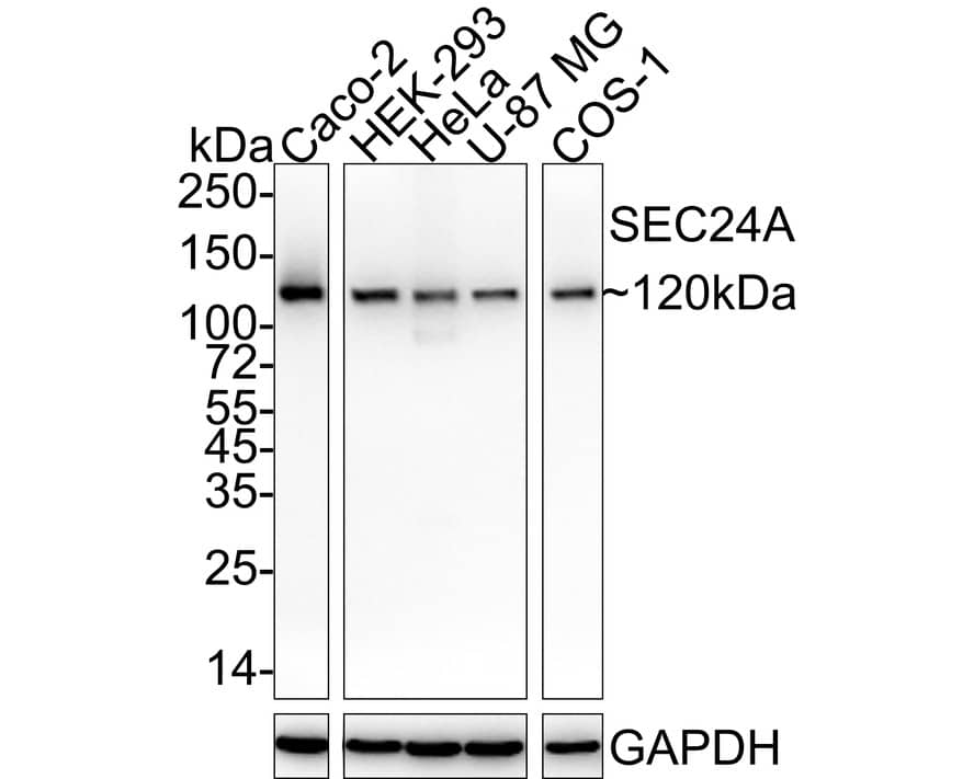 Western blot analysis on different lysates with NBP3-32936 at 1/2,000 dilution. Lane 1: Caco-2 cell lysate Lane 2: HEK-293 cell lysate Lane 3: HeLa cell lysate Lane 4: U-87 MG cell lysate Lane 5: COS-1 cell lysate Lysates/proteins at 20 µg/Lane. Predicted band size: 120 kDa Observed band size: 120 kDa Exposure time: 24 seconds;  4-20% SDS-PAGE gel. Proteins were transferred to a PVDF membrane and blocked with 5% NFDM/TBST for 1 hour at room temperature. NBP3-32936 at 1/2,000 dilution was used in 5% NFDM/TBST at 4℃ overnight. Goat Anti-Rabbit IgG [HRP] Secondary Antibody at 1/50,000 dilution was used for 1 hour at room temperature.