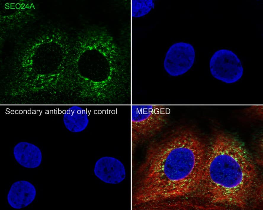 Immunocytochemistry/ Immunofluorescence SEC24A Antibody (PSH04-36)