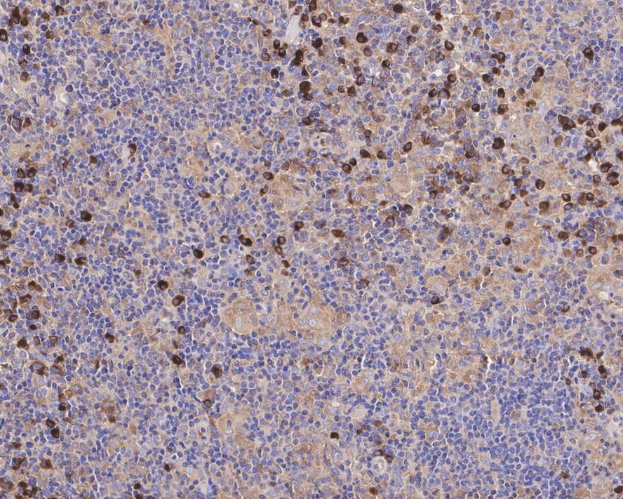 Immunohistochemistry SEC24A Antibody (PSH04-36)