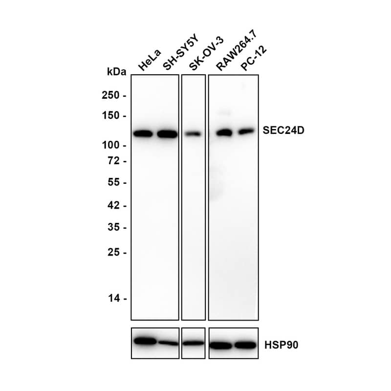 Western blot analysis on different lysates with NBP3-32937 at 1/2,000 dilution. Lane 1: HeLa cell lysate Lane 2: SH-SY5Y cell lysate Lane 3: SK-OV-3 cell lysate Lane 4: RAW264.7 cell lysate Lane 5: PC-12 cell lysate Lysates/proteins at 20 µg/Lane. Exposure time: 60 seconds Blocking: 5% NFDM/TBST, 1 hour at room temperature Primary antibody: NBP3-32937, 1/2,000 in 5% NFDM/TBST, overnight at 4 ℃ Secondary antibody: Goat Anti-Rabbit IgG [HRP] Secondary Antibody, 1/50,000 in 5% NFDM/TBST, 1 hour at room temperature Predicted band size: 113 kDa Observed band size: 113 kDa
