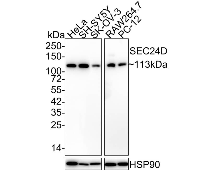 Western Blot SEC24D Antibody (JE65-27)