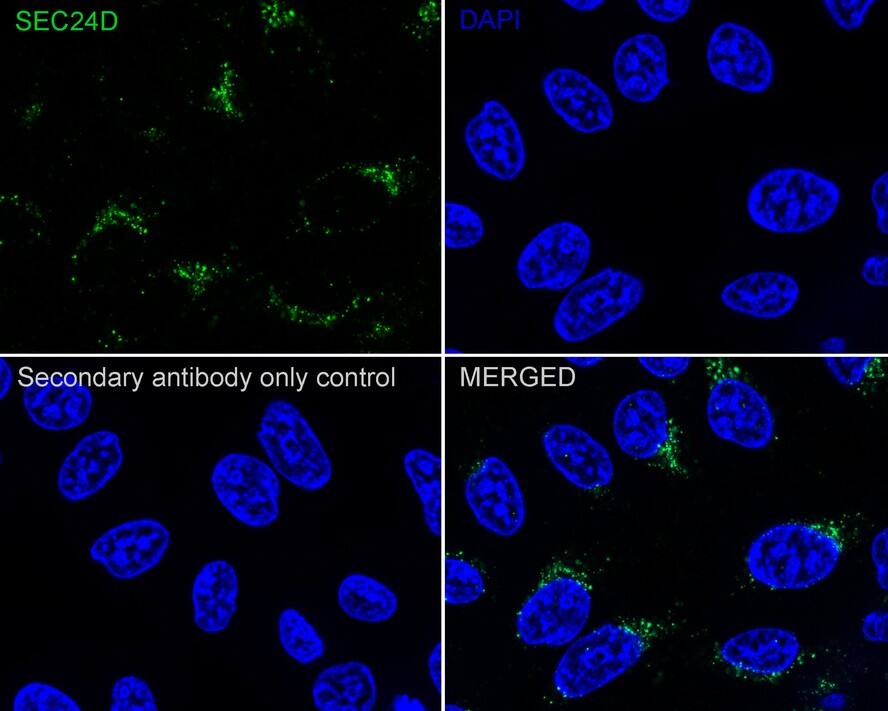 Immunocytochemistry/ Immunofluorescence SEC24D Antibody (JE65-27)