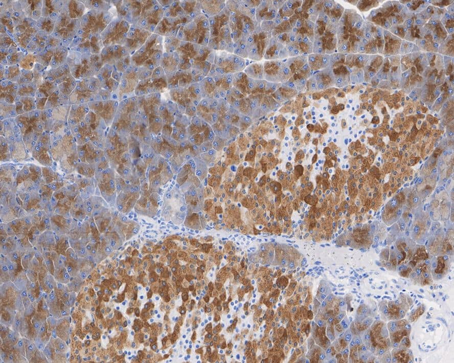 Immunohistochemistry SEC24D Antibody (JE65-27)