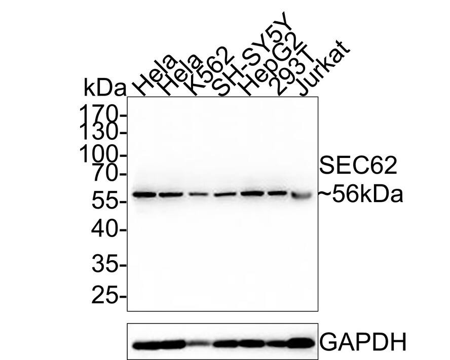 Western blot analysis on different lysates with NBP3-32939 at 1/5,000 dilution. Lane 1: Hela cell lysate (20 µg/Lane) Lane 2: Hela cell lysate (20 µg/Lane) Lane 3: K562 cell lysate (20 µg/Lane) Lane 4: SH-SY5Y cell lysate (20 µg/Lane) Lane 5: HepG2 cell lysate (20 µg/Lane) Lane 6: 293T cell lysate (20 µg/Lane) Lane 7: Jurkat cell lysate (20 µg/Lane) Predicted band size: 46 kDa Observed band size: 56 kDa Exposure time: 30 seconds; 10% SDS-PAGE gel. Proteins were transferred to a PVDF membrane and blocked with 5% NFDM/TBST for 1 hour at room temperature. NBP3-32939 at 1/5,000 dilution was used in 5% NFDM/TBST at room temperature for 2 hours. Goat Anti-Rabbit IgG [HRP] Secondary Antibody at 1:200,000 dilution was used for 1 hour at room temperature.