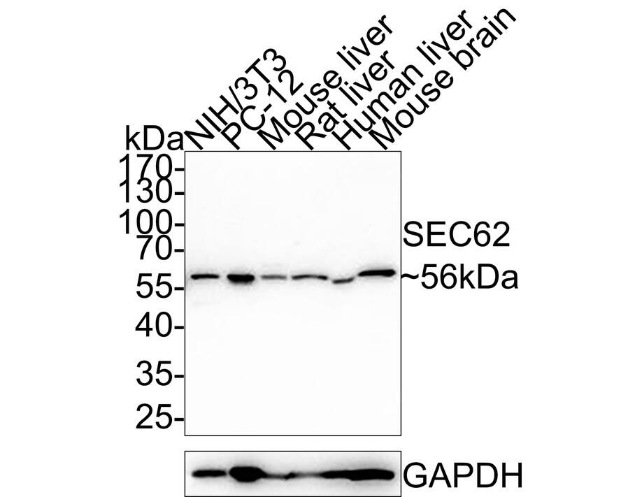 Western blot analysis on different lysates with NBP3-32939 at 1/5,000 dilution. Lane 1: NIH/3T3 cell lysate (20 µg/Lane) Lane 2: PC-12 cell lysate (20 µg/Lane) Lane 3: Mouse liver tissue lysate (40 µg/Lane) Lane 4: Rat liver tissue lysate (40 µg/Lane) Lane 5: Human liver tissue lysate (40 µg/Lane) Lane 6: Mouse brain tissue lysate (40 µg/Lane) Predicted band size: 46 kDa Observed band size: 56 kDa Exposure time: 2 minutes; 10% SDS-PAGE gel. Proteins were transferred to a PVDF membrane and blocked with 5% NFDM/TBST for 1 hour at room temperature. NBP3-32939 at 1/5,000 dilution was used in 5% NFDM/TBST at room temperature for 2 hours. Goat Anti-Rabbit IgG [HRP] Secondary Antibody at 1:200,000 dilution was used for 1 hour at room temperature.