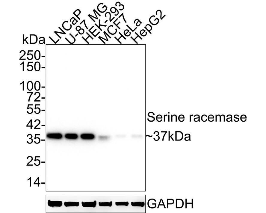 Western blot analysis on different lysates with NBP3-32943 at 1/1,000 dilution. Lane 1: LNCaP cell lysate Lane 2: U-87 MG cell lysate Lane 3: HEK-293 cell lysate Lane 4: MCF7 cell lysate Lane 5: HeLa cell lysate Lane 6: HepG2 cell lysate Lysates/proteins at 20 µg/Lane. Predicted band size: 37 kDa Observed band size: 37 kDa Exposure time: 1 minute 59 seconds;  4-20% SDS-PAGE gel. Proteins were transferred to a PVDF membrane and blocked with 5% NFDM/TBST for 1 hour at room temperature. NBP3-32943 at 1/1,000 dilution was used in 5% NFDM/TBST at 4℃ overnight. Goat Anti-Rabbit IgG [HRP] Secondary Antibody at 1/50,000 dilution was used for 1 hour at room temperature.