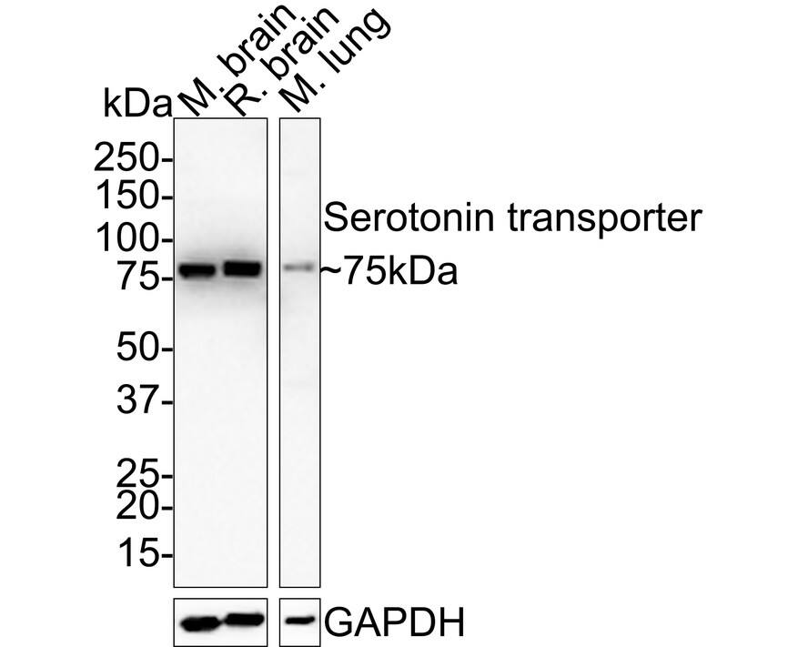 Western blot analysis on different lysates with NBP3-32944 at 1/1,000 dilution. Lane 1: Mouse brain tissue lysate Lane 2: Rat brain tissue lysate Lane 3: Mouse lung tissue lysate Lysates/proteins at 30 µg/Lane. Predicted band size: 70 kDa Observed band size: 75 kDa Exposure time: 28 seconds; 4-20% SDS-PAGE gel. Proteins were transferred to a PVDF membrane and blocked with 5% NFDM/TBST for 1 hour at room temperature. NBP3-32944 at 1/1,000 dilution was used in 5% NFDM/TBST at room temperature for 2 hours. Goat Anti-Rabbit IgG [HRP] Secondary Antibody at 1:100,000 dilution was used for 1 hour at room temperature.
