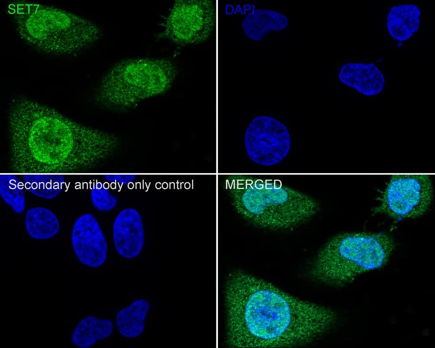 Immunocytochemistry/ Immunofluorescence: SETD7 Antibody (PSH02-90) [NBP3-32945] - Immunocytochemistry analysis of HeLa cells labeling SETD7 with Rabbit anti-SETD7 antibody (NBP3-32945) at 1/100 dilution. Cells were fixed in 4% paraformaldehyde for 20 minutes at room temperature, permeabilized with 0.1% Triton X-100 in PBS for 5 minutes at room temperature, then blocked with 1% BSA in 10% negative goat serum for 1 hour at room temperature. Cells were then incubated with Rabbit anti-SETD7 antibody (NBP3-32945) at 1/100 dilution in 1% BSA in PBST overnight at 4 ℃. Goat Anti-Rabbit IgG H&L (iFluor™ 488) was used as the secondary antibody at 1/1,000 dilution. PBS instead of the primary antibody was used as the secondary antibody only control. Nuclear DNA was labelled in blue with DAPI.