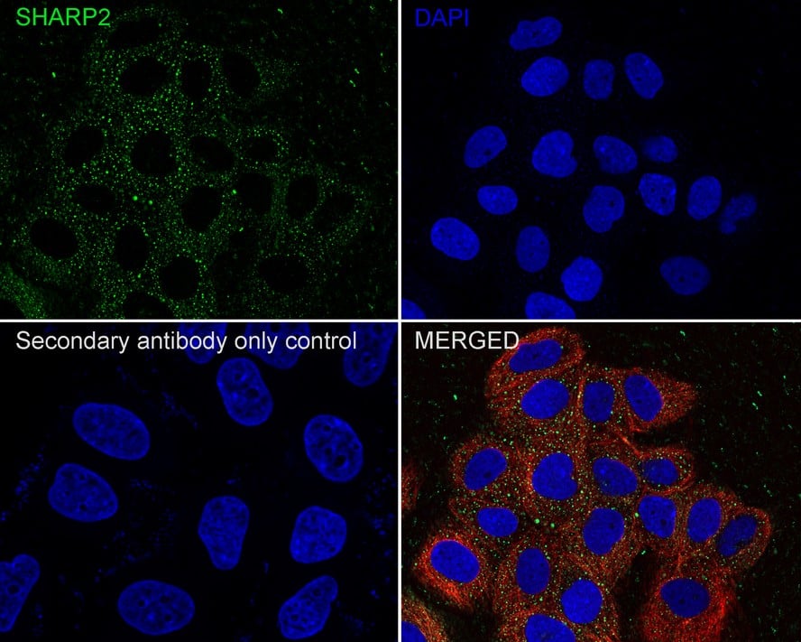 Immunocytochemistry/ Immunofluorescence: DEC1 Antibody (PSH01-90) [NBP3-32946] - Immunocytochemistry analysis of MCF7 cells labeling DEC1 with Rabbit anti-DEC1 antibody (NBP3-32946) at 1/100 dilution. Cells were fixed in 100% precooled methanol for 5 minutes at room temperature, then blocked with 1% BSA in 10% negative goat serum for 1 hour at room temperature. Cells were then incubated with Rabbit anti-DEC1 antibody (NBP3-32946) at 1/100 dilution in 1% BSA in PBST overnight at 4 ℃. Goat Anti-Rabbit IgG H&L (iFluor™ 488) was used as the secondary antibody at 1/1,000 dilution. PBS instead of the primary antibody was used as the secondary antibody only control. Nuclear DNA was labelled in blue with DAPI. Beta tubulin (red) was stained at 1/100 dilution overnight at +4℃. Goat Anti-Mouse IgG H&L (iFluor™ 594) was used as the secondary antibody at 1/1,000 dilution.