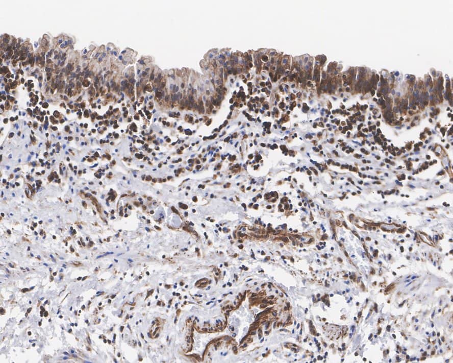 Immunohistochemistry: DEC1 Antibody (PSH01-90) [NBP3-32946] - Immunohistochemical analysis of paraffin-embedded human bladder tissue with Rabbit anti-DEC1 antibody (NBP3-32946) at 1/1,000 dilution. The section was pre-treated using heat mediated antigen retrieval with sodium citrate buffer (pH 6.0) for 2 minutes. The tissues were blocked in 1% BSA for 20 minutes at room temperature, washed with ddH2O and PBS, and then probed with the primary antibody (NBP3-32946) at 1/1,000 dilution for 1 hour at room temperature. The detection was performed using an HRP conjugated compact polymer system. DAB was used as the chromogen. Tissues were counterstained with hematoxylin and mounted with DPX.