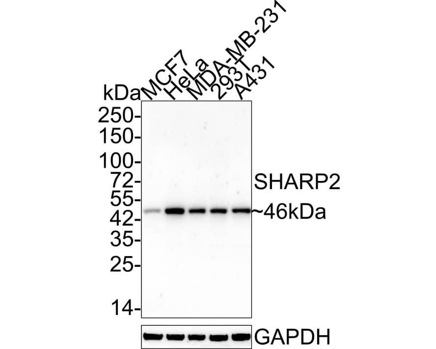 Western blot analysis on different lysates with NBP3-32947 at 1/1,000 dilution. Lane 1: MCF7 cell lysate Lane 2: HeLa cell lysate Lane 3: MDA-MB-231 cell lysate Lane 4: 293T cell lysate Lane 5: A431 cell lysate Lysates/proteins at 20 µg/Lane. Predicted band size: 46 kDa Observed band size: 46 kDa Exposure time: 3 minutes; 4-20% SDS-PAGE gel. Proteins were transferred to a PVDF membrane and blocked with 5% NFDM/TBST for 1 hour at room temperature. NBP3-32947 at 1/1,000 dilution was used in 5% NFDM/TBST at 4℃ overnight. Goat Anti-Rabbit IgG [HRP] Secondary Antibody at 1/50,000 dilution was used for 1 hour at room temperature.