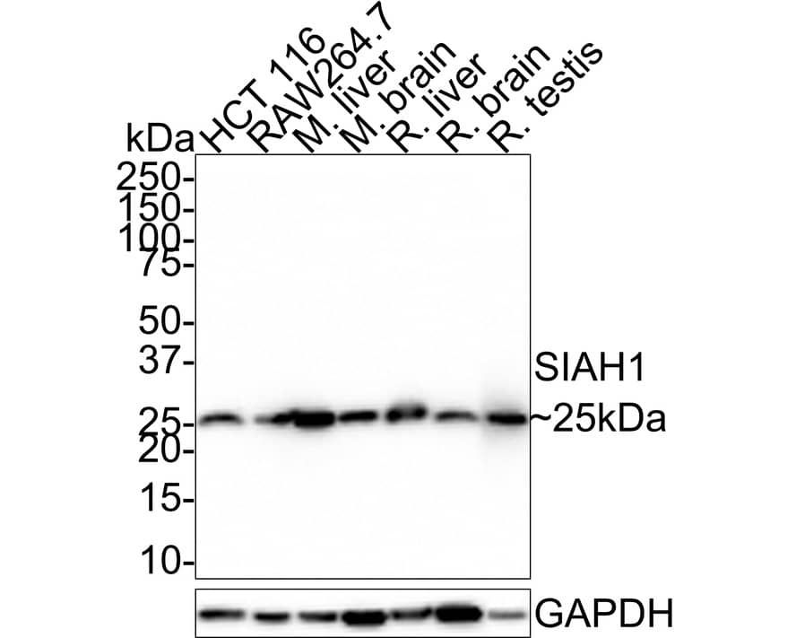 Western Blot: SIAH1 Antibody (PSH01-80) [NBP3-32949] - Western blot analysis of SIAH1 on different lysates with Rabbit anti-SIAH1 antibody (NBP3-32949) at 1/1,000 dilution. Lane 1: HCT 116 cell lysate(20 ug/Lane) Lane 2: RAW264.7 cell lysate(20 ug/Lane) Lane 3: Mouse liver tissue lysate(40 ug/Lane) Lane 4:  Mouse brain tissue lysate(40 ug/Lane) Lane 5: Rat liver tissue lysate(40 ug/Lane) Lane 6: Rat brain tissue lysate(40 ug/Lane) Lane 7: Rat testis testis lysate(40 ug/Lane) Predicted band size: 31 kDa Observed band size: 25 kDa Exposure time: 20 seconds; 4-20% SDS-PAGE gel. Proteins were transferred to a PVDF membrane and blocked with 5% NFDM/TBST for 1 hour at room temperature. The primary antibody (NBP3-32949) at 1/1,000 dilution was used in 5% NFDM/TBST at room temperature for 2 hours. Goat Anti-Rabbit IgG - HRP Secondary Antibody at 1/100,000 dilution was used for 1 hour at room temperature.
