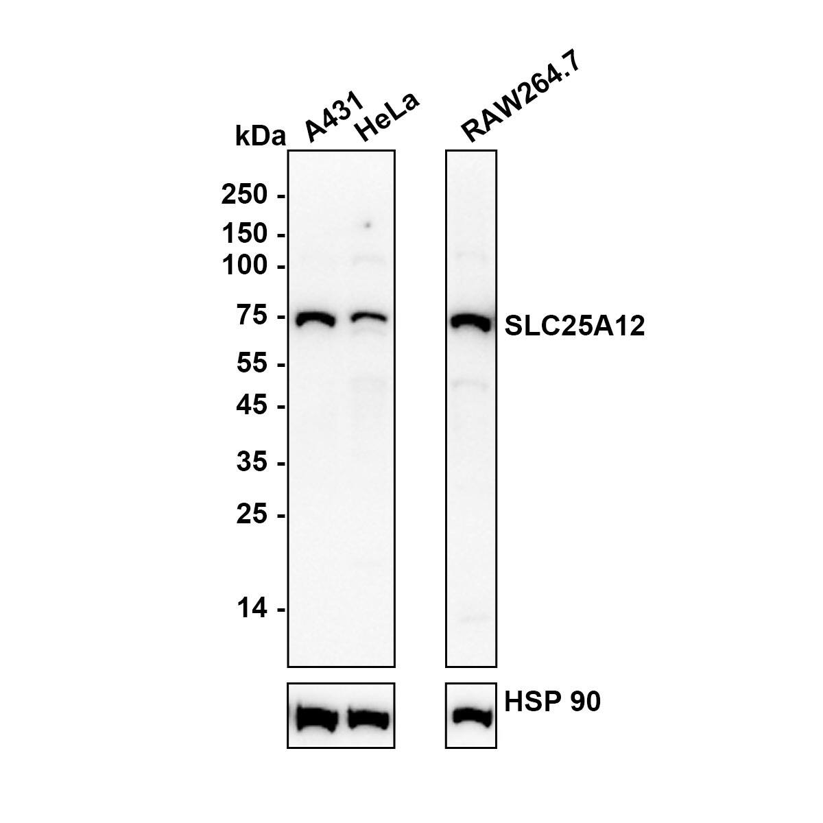 Western blot analysis on different lysates with NBP3-32952 at 1/1,000 dilution. Lane 1: A431 (Human epidermoid carcinoma skin squamous cell) cell lysate Lane 2: HeLa (Human cervical adenocarcinoma cell) cell lysate Lane 3: RAW264.7 (Mouse monocytic macrophage leukemia cell) cell lysate Lysates/proteins at 20 µg/Lane. Exposure time: 80 seconds; ECL: K1802 Blocking: 5% NFDM/TBST, 1 hour at room temperature Primary antibody: NBP3-32952, 1/1,000 in primary antibody dilution buffer, overnight at 4 ℃ Secondary antibody: Goat Anti-Rabbit IgG [HRP] Secondary Antibody, 1/50,000 in 5% NFDM/TBST, 1 hour at room temperature Predicted band size: 74.8 kDa Observed band size: 70 kDa