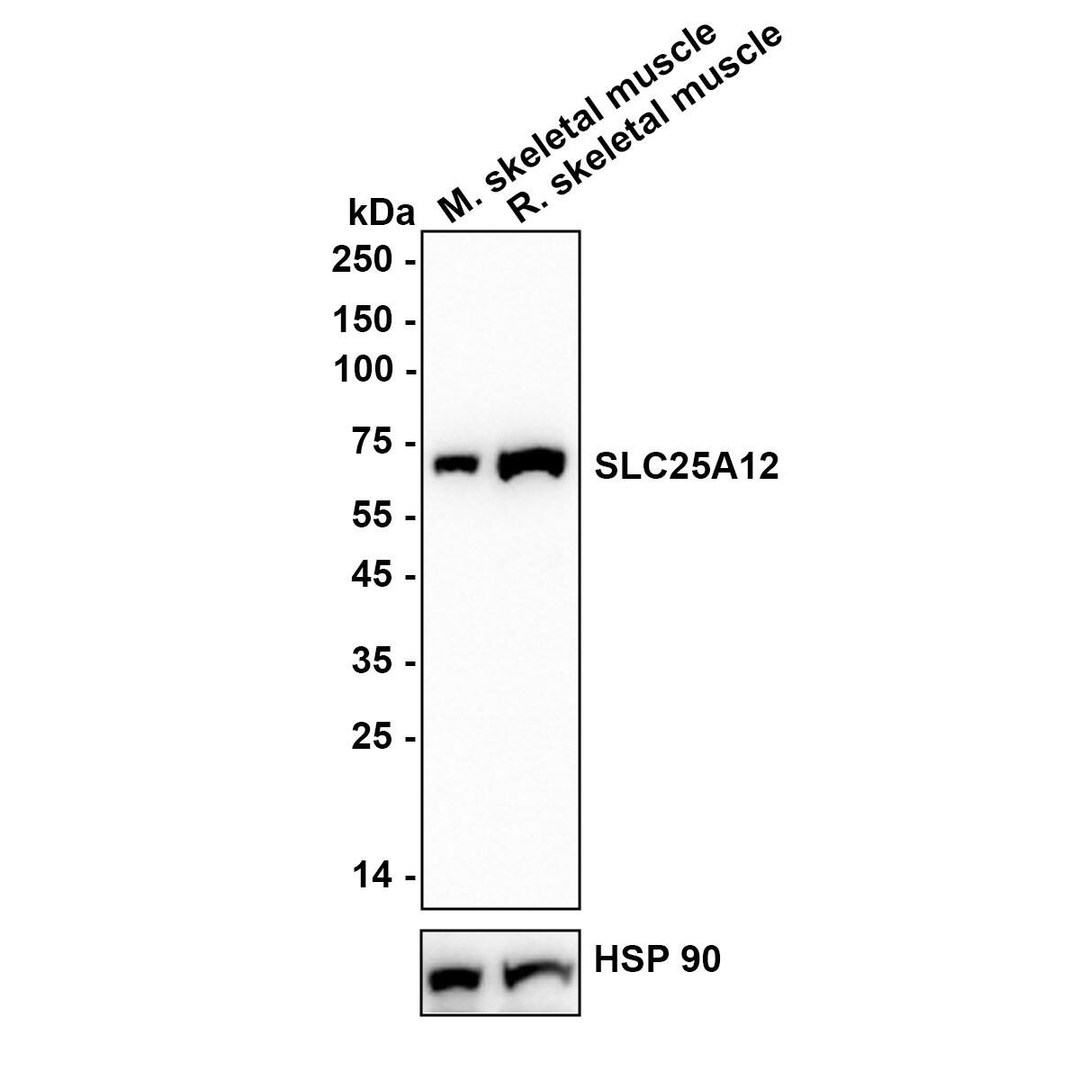Western blot analysis on different lysates with NBP3-32952 at 1/1,000 dilution. Lane 1: Mouse skeletal muscle tissue lysate Lane 2: Rat skeletal muscle tissue lysate Lysates/proteins at 30 µg/Lane. Exposure time: 30 seconds Blocking: 5% NFDM/TBST, 1 hour at room temperature Primary antibody: NBP3-32952, 1/1,000 in primary antibody dilution buffer, overnight at 4 ℃ Secondary antibody: Goat Anti-Rabbit IgG [HRP] Secondary Antibody, 1/50,000 in 5% NFDM/TBST, 1 hour at room temperature Predicted band size: 74.8 kDa Observed band size: 70 kDa