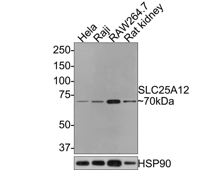 Western Blot: SLC25A12 Antibody (JE65-52) [NBP3-32952] - Western blot analysis of SLC25A12 on different lysates with Rabbit anti-SLC25A12 antibody (NBP3-32952) at 1/500 dilution. Lane 1: Hela cell lysate Lane 2: Raji cell lysate Lane 3: RAW264.7 cell lysate Lane 4: Rat kidney tissue lysate (20 ug/Lane) Lysates/proteins at 10 ug/Lane. Predicted band size: 75 kDa Observed band size: 70 kDa Exposure time: 2 minutes; 8% SDS-PAGE gel. Proteins were transferred to a PVDF membrane and blocked with 5% NFDM/TBST for 1 hour at room temperature. The primary antibody (NBP3-32952) at 1/500 dilution was used in 5% NFDM/TBST at room temperature for 2 hours. Goat Anti-Rabbit IgG - HRP Secondary Antibody at 1:300,000 dilution was used for 1 hour at room temperature.