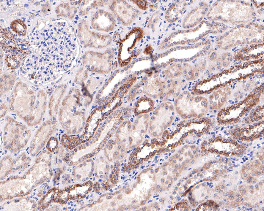 Immunohistochemistry: SLC25A12 Antibody (JE65-52) [NBP3-32952] - Immunohistochemical analysis of paraffin-embedded human kidney tissue with Rabbit anti-SLC25A12 antibody (NBP3-32952) at 1/100 dilution. The section was pre-treated using heat mediated antigen retrieval with Tris-EDTA buffer (pH 9.0) for 20 minutes. The tissues were blocked in 1% BSA for 20 minutes at room temperature, washed with ddH2O and PBS, and then probed with the primary antibody (NBP3-32952) at 1/100 dilution for 1 hour at room temperature. The detection was performed using an HRP conjugated compact polymer system. DAB was used as the chromogen. Tissues were counterstained with hematoxylin and mounted with DPX.