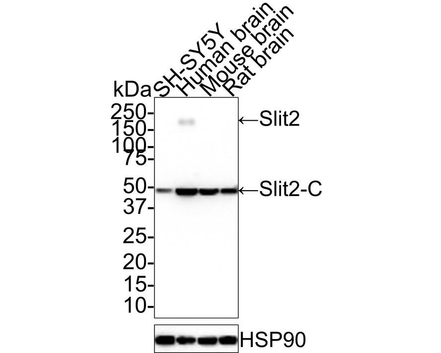 Western blot analysis on different lysates with NBP3-32955 at 1/1,000 dilution. Lane 1: SH-SY5Y cell lysate (15 µg/Lane) Lane 2: Human brain tissue lysate (30 µg/Lane) Lane 3: Mouse brain tissue lysate (30 µg/Lane) Lane 4: Rat brain tissue lysate (30 µg/Lane) Predicted band size: 170 kDa Observed band size: 50/200 kDa Exposure time: 28 seconds; 4-20% SDS-PAGE gel. Proteins were transferred to a PVDF membrane and blocked with 5% NFDM/TBST for 1 hour at room temperature. NBP3-32955 at 1/1,000 dilution was used in 5% NFDM/TBST at room temperature for 2 hours. Goat Anti-Rabbit IgG [HRP] Secondary Antibody at 1:100,000 dilution was used for 1 hour at room temperature.