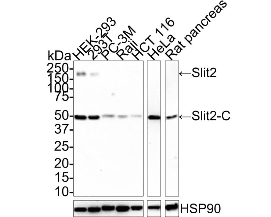 Western Blot: Slit2 Antibody (JE31-87) [NBP3-32955] - Western blot analysis of Slit2 on different lysates with Rabbit anti-Slit2 antibody (NBP3-32955) at 1/1,000 dilution. Lane 1: HEK-293 cell lysate (15 ug/Lane) Lane 2: 293T cell lysate (15 ug/Lane) Lane 3: PC-3M cell lysate (15 ug/Lane) Lane 4: Raji cell lysate (15 ug/Lane) Lane 5: HCT 116 cell lysate (15 ug/Lane) Lane 6: HeLa cell lysate (15 ug/Lane) Lane 7: Rat pancreas tissue lysate (30 ug/Lane) Predicted band size: 170 kDa Observed band size: 50/200 kDa Exposure time: 3 minutes; 4-20% SDS-PAGE gel. Proteins were transferred to a PVDF membrane and blocked with 5% NFDM/TBST for 1 hour at room temperature. The primary antibody (NBP3-32955) at 1/1,000 dilution was used in 5% NFDM/TBST at room temperature for 2 hours. Goat Anti-Rabbit IgG - HRP Secondary Antibody at 1:100,000 dilution was used for 1 hour at room temperature.