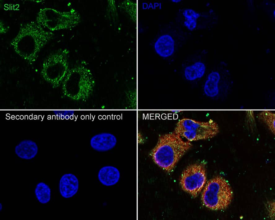 Immunocytochemistry/ Immunofluorescence: Slit2 Antibody (JE31-87) [NBP3-32955] - Immunocytochemistry analysis of A549 cells labeling Slit2 with Rabbit anti-Slit2 antibody (NBP3-32955) at 1/100 dilution. Cells were fixed in 4% paraformaldehyde for 10 minutes at 37 ℃, permeabilized with 0.05% Triton X-100 in PBS for 20 minutes, and then blocked with 2% negative goat serum for 30 minutes at room temperature. Cells were then incubated with Rabbit anti-Slit2 antibody (NBP3-32955) at 1/100 dilution in 2% negative goat serum overnight at 4 ℃. Goat Anti-Rabbit IgG H&L (iFluor™ 488) was used as the secondary antibody at 1/1,000 dilution. Nuclear DNA was labelled in blue with DAPI. Beta tubulin (red) was stained at 1/200 dilution overnight at +4℃. Goat Anti-Mouse IgG H&L (iFluor™ 594) was used as the secondary antibody at 1/1,000 dilution.