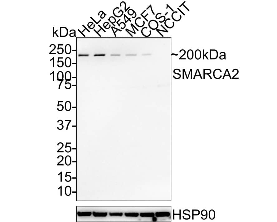 Western Blot: BRM Antibody (PSH01-15) [NBP3-32957] - Western blot analysis of BRM on different lysates with Rabbit anti-BRM antibody (NBP3-32957) at 1/1,000 dilution. Lane 1: HeLa cell lysate Lane 2: HepG2 cell lysate Lane 3: A549 cell lysate Lane 4: MCF7 cell lysate Lane 5: COS-1 cell lysate Lane 6: NCCIT cell lysate (low expression) Lysates/proteins at 30 ug/Lane. Predicted band size: 181 kDa Observed band size: 200 kDa Exposure time: 3 minutes 10 seconds; 4-20% SDS-PAGE gel. Proteins were transferred to a PVDF membrane and blocked with 5% NFDM/TBST for 1 hour at room temperature. The primary antibody (NBP3-32957) at 1/1,000 dilution was used in 5% NFDM/TBST at room temperature for 2 hours. Goat Anti-Rabbit IgG - HRP Secondary Antibody at 1:100,000 dilution was used for 1 hour at room temperature.