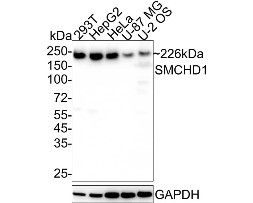 Western Blot: SMCHD1 Antibody (JE34-29) [NBP3-32960] - Western blot analysis of SMCHD1 on different lysates with Rabbit anti-SMCHD1 antibody (NBP3-32960) at 1/1,000 dilution. Lane 1: 293T cell lysate Lane 2: HepG2 cell lysate Lane 3: HeLa cell lysate Lane 4: U-87 MG cell lysate Lane 5: U-2 OS cell lysate Lysates/proteins at 20 ug/Lane. Predicted band size: 226 kDa Observed band size: 226 kDa Exposure time: 30 seconds; ECL; 4-20% SDS-PAGE gel. Proteins were transferred to a PVDF membrane and blocked with 5% NFDM/TBST for 1 hour at room temperature. The primary antibody (NBP3-32960) at 1/1,000 dilution was used in 5% NFDM/TBST at 4C overnight. Goat Anti-Rabbit IgG - HRP Secondary Antibody at 1/50,000 dilution was used for 1 hour at room temperature.