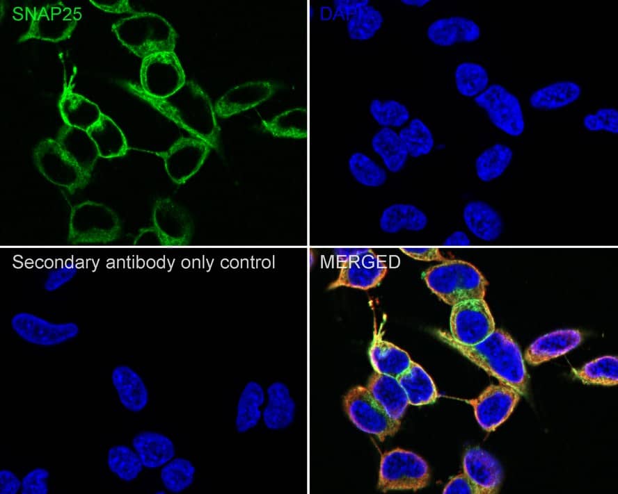 Immunocytochemistry/ Immunofluorescence: SNAP25 Antibody (JE45-86) [NBP3-32961] - Immunocytochemistry analysis of SH-SY5Y cells labeling SNAP25 with Rabbit anti-SNAP25 antibody (NBP3-32961) at 1/100 dilution. Cells were fixed in 4% paraformaldehyde for 20 minutes at room temperature, permeabilized with 0.1% Triton X-100 in PBS for 5 minutes at room temperature, then blocked with 1% BSA in 10% negative goat serum for 1 hour at room temperature. Cells were then incubated with Rabbit anti-SNAP25 antibody (NBP3-32961) at 1/100 dilution in 1% BSA in PBST overnight at 4 ℃. Goat Anti-Rabbit IgG H&L (iFluor™ 488) was used as the secondary antibody at 1/1,000 dilution. PBS instead of the primary antibody was used as the secondary antibody only control. Nuclear DNA was labelled in blue with DAPI. Beta tubulin (red) was stained at 1/100 dilution overnight at +4℃. Goat Anti-Mouse IgG H&L (iFluor™ 594) was used as the secondary antibody at 1/1,000 dilution.