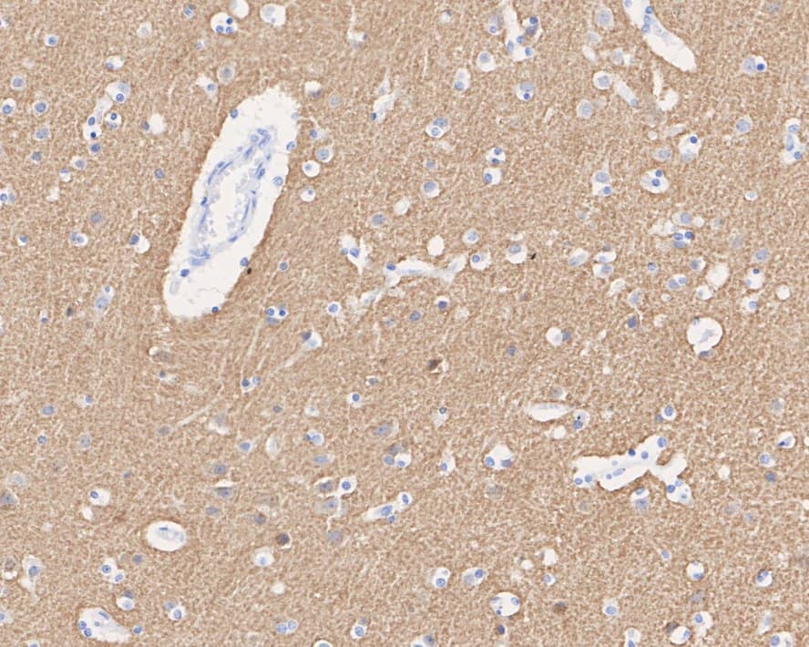 Immunohistochemistry: SNAP25 Antibody (JE45-86) [NBP3-32961] - Immunohistochemical analysis of paraffin-embedded human brain tissue with Rabbit anti-SNAP25 antibody (NBP3-32961) at 1/500 dilution. The section was pre-treated using heat mediated antigen retrieval with Tris-EDTA buffer (pH 9.0) for 20 minutes. The tissues were blocked in 1% BSA for 20 minutes at room temperature, washed with ddH2O and PBS, and then probed with the primary antibody (NBP3-32961) at 1/500 dilution for 1 hour at room temperature. The detection was performed using an HRP conjugated compact polymer system. DAB was used as the chromogen. Tissues were counterstained with hematoxylin and mounted with DPX.