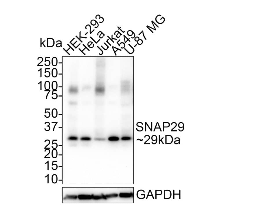 Western Blot: SNAP29 Antibody (PSH01-76) [NBP3-32962] - Western blot analysis of SNAP29 on different lysates with Rabbit anti-SNAP29 antibody (NBP3-32962) at 1/1,000 dilution. Lane 1: HEK-293 cell lysate Lane 2: HeLa cell lysate Lane 3: Jurkat cell lysate Lane 4: A549 cell lysate Lane 5: U-87 MG cell lysate Lysates/proteins at 40 ug/Lane. Predicted band size: 29 kDa Observed band size: 29 kDa Exposure time: 5 minutes 10 seconds; 4-20% SDS-PAGE gel. Proteins were transferred to a PVDF membrane and blocked with 5% NFDM/TBST for 1 hour at room temperature. The primary antibody (NBP3-32962) at 1/1,000 dilution was used in 5% NFDM/TBST at 4C overnight. Goat Anti-Rabbit IgG - HRP Secondary Antibody at 1/50,000 dilution was used for 1 hour at room temperature.