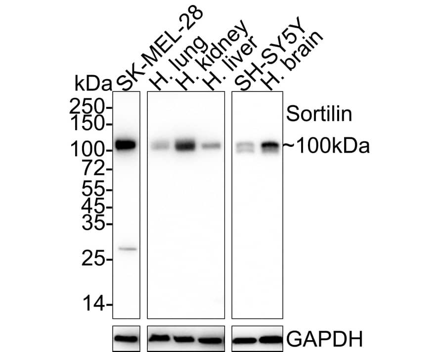 Western Blot: Sortilin Antibody (JE60-00) [NBP3-32968] - Western blot analysis of Sortilin on different lysates with Rabbit anti-Sortilin antibody (NBP3-32968) at 1/1,000 dilution. Lane 1: SK-MEL-28 cell lysate (20 ug/Lane) Lane 2: Human lung tissue lysate (40 ug/Lane) Lane 3: Human kidney tissue lysate (40 ug/Lane) Lane 4: Human liver tissue lysate (40 ug/Lane) Lane 5: SH-SY5Y cell lysate (20 ug/Lane) Lane 6: Human brain tissue lysate (40 ug/Lane) Predicted band size: 92 kDa Observed band size: 100 kDa Exposure time: Lane 1-4: 1 minute 7 seconds; Lane 5-6:  2 minutes 37 seconds; 4-20% SDS-PAGE gel. Proteins were transferred to a PVDF membrane and blocked with 5% NFDM/TBST for 1 hour at room temperature. The primary antibody (NBP3-32968) at 1/1,000 dilution was used in 5% NFDM/TBST at 4C overnight. Goat Anti-Rabbit IgG - HRP Secondary Antibody at 1/50,000 dilution was used for 1 hour at room temperature.